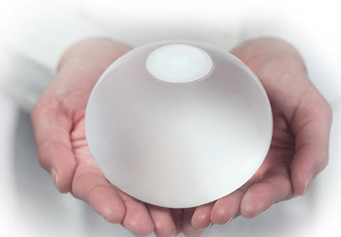 BALON INTRAGÁSTRICO ORBERA 